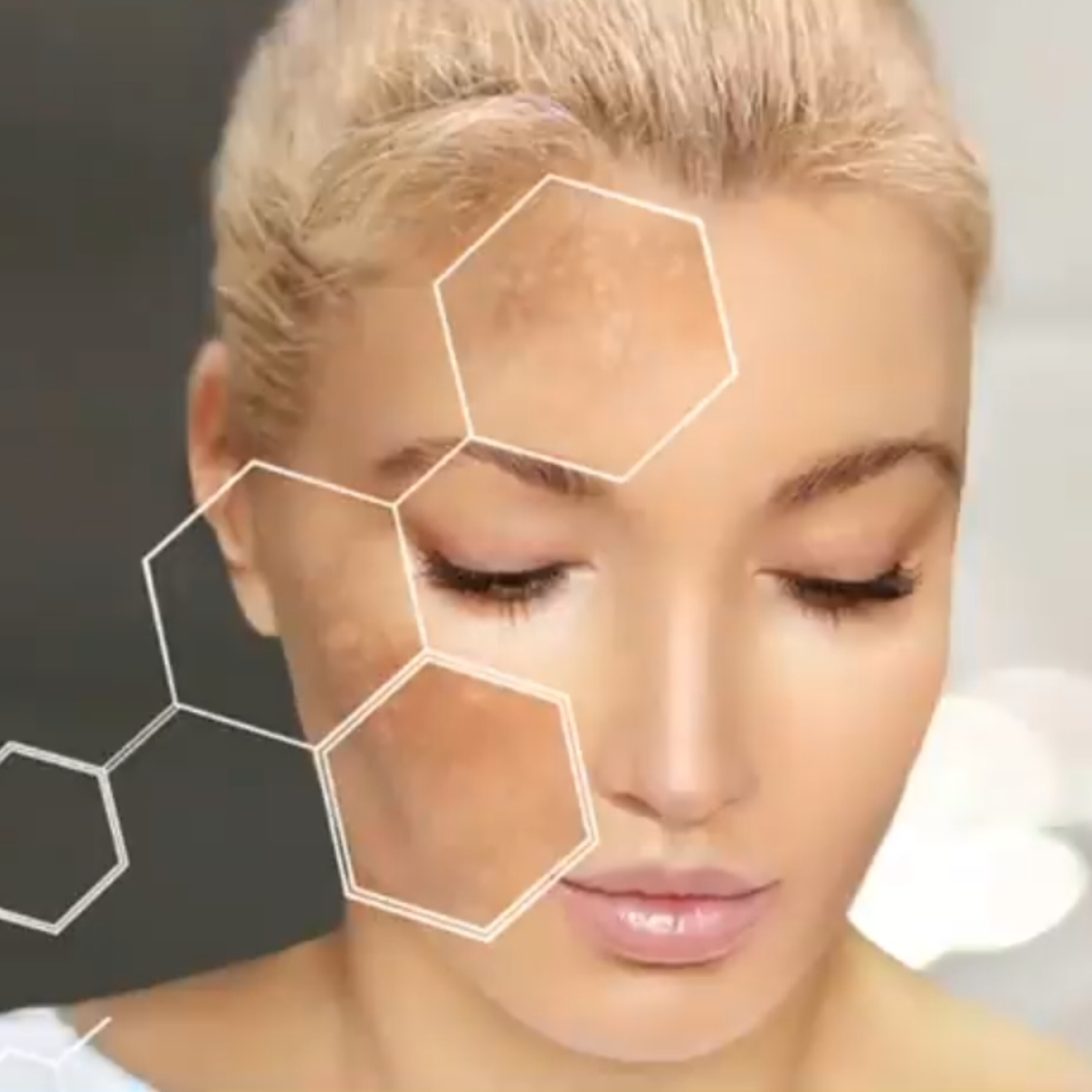 دلايل ایجاد لک و بهترین راهکارها برای درمان آن